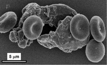 OSP among red blood cells