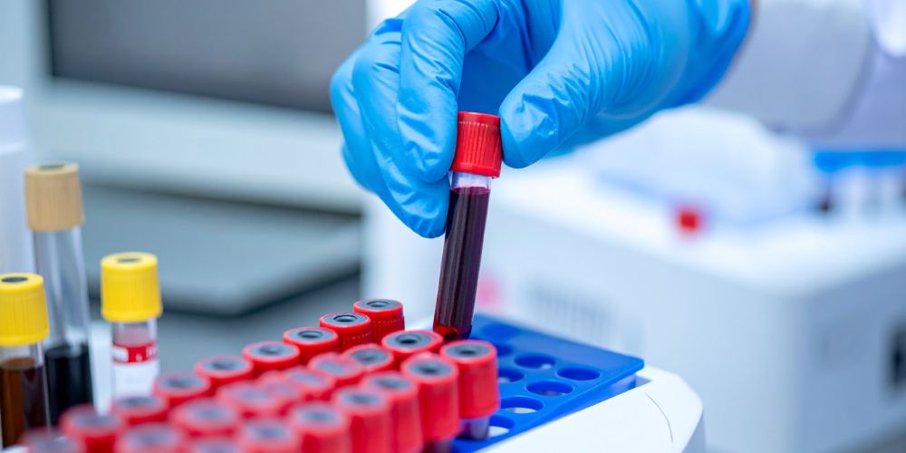 UTA study finds certain blood markers could identify cardiovascular problems earlier than expected